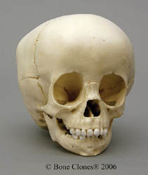 Human Child Skull 1-1/2-year-old (14-22 months) 
